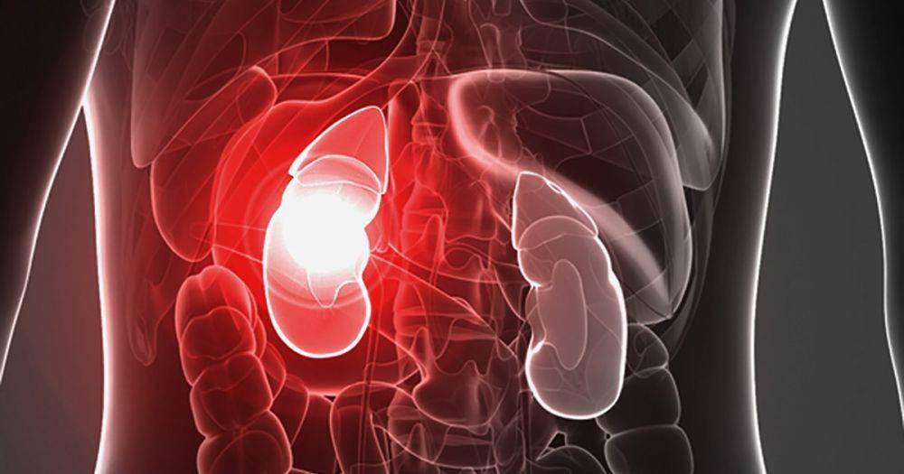 kidney.org