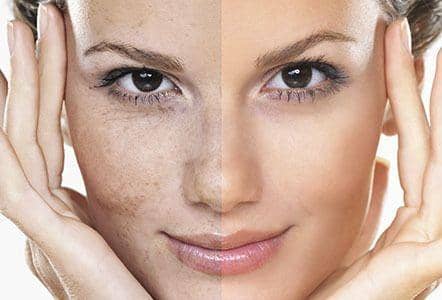 Getty Images/iStockphoto