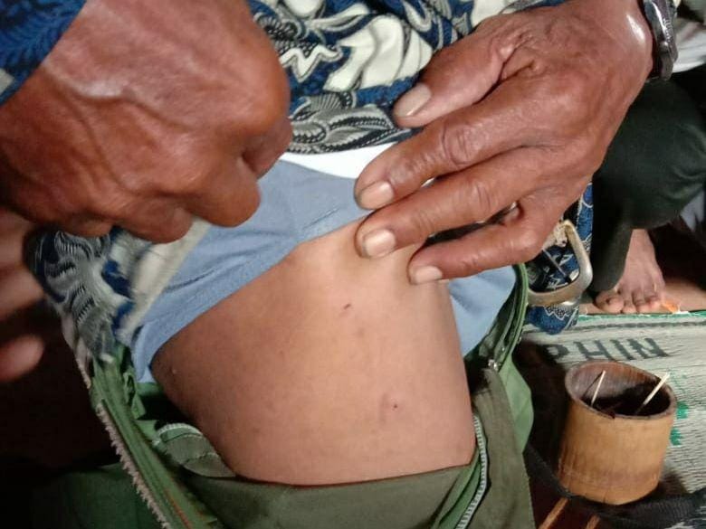 Korban cakaran harimau di kawasan perbatasan hutan Lindung Bukit Jambul Gunung Patah, Kecamatan Semende Darat Laut, Kabupaten Muara Enim (IDN Times/BKSDA Lahat)