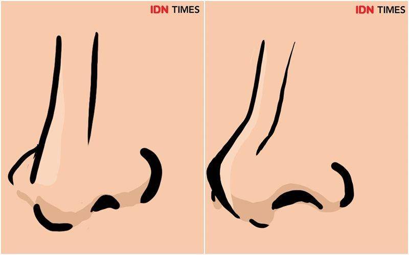 IDN Times/Alfisyahrin Zulfahri Akbar