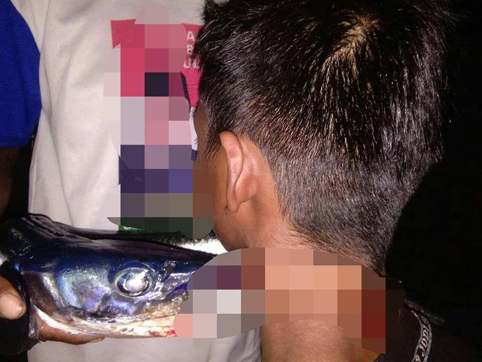Remaja asal Buton Selatan tertancap ikan sori di leher. Dok. IDN Times/Istimewa