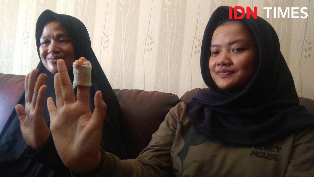 Ibu Elis Aryani dan anaknya, Yusni Widya Utami menunjukkan luka benda tajam akibat berebut golok dengan perampok di rumahnya. (IDN Times/Wildan Ibnu)