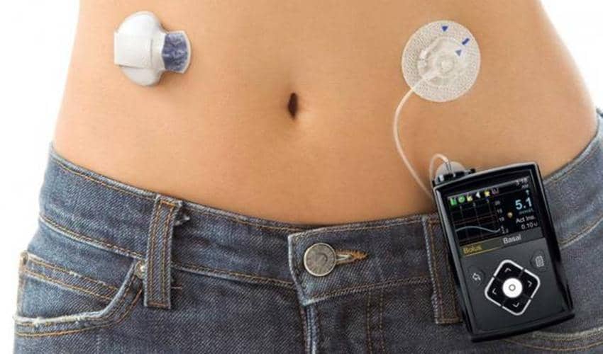 https://cdn.idntimes.com/content-images/post/20161124/artificial-pancreas-medtronic-fda-medtech-bf7f41019caf0389bab48b0cccae51b9.jpg