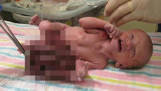 http://cdn.idntimes.com/content-images/post/20160805/dailymail1-b9781c699cfe9d9ea1266318a64336ab.jpg