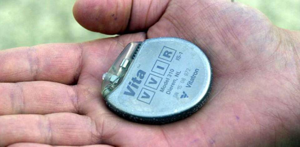 http://cdn.idntimes.com/content-images/post/20160806/pacemaker-960x472-caa0f6fbbde74344be1da5be02c99b7e.jpg