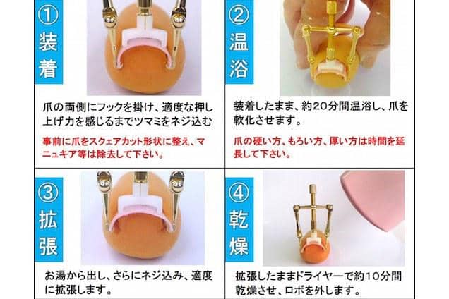 https://cdn.idntimes.com/content-images/post/20170806/beauty-products-2015-06-makizume-robo-ingrown-toenail-fixer-c4d0af1aa5d6ba12e5b82fc9ef6ccf0e.jpg